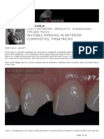 Invisible Margins in Anterior Composites, Tips&Tricks