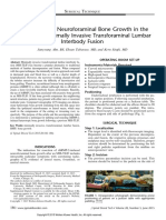 BMP-2-induced Neuroforaminal Bone Growth in The Setting of A Minimally Invasive Transforaminal Lumbar Interbody Fusion