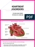 Heartbeat Disorders: by Aisha Sara Tasnim Physician: Dr. Ssebuliba