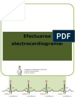 Electrocardiograma