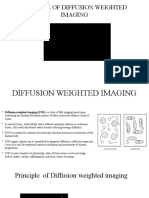Mri Role of Diffusion Weighted Imaging