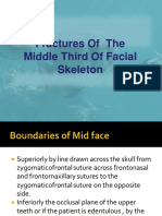 Fractures Midface copy.pdf