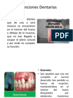 Retenciones Dentarias.pptx
