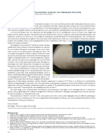 Malassezia: A Case of Coexisting Pityriasis Versicolor and Malassezia Folliculitis