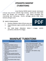 Kontrasepsi Mantap (Tubektomi)