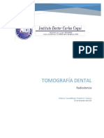 Tomografía Dental
