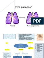 Edema pulmonar: causas, síntomas y tratamiento