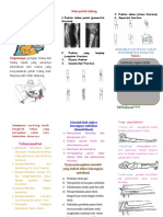 Leaflet Post Frakture