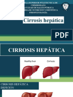 Cirrosis hepática: factores, clasificación y tratamiento nutricional