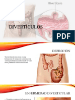 Divertículos