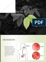 GASTRITIS y Litiasis