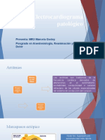 Electrocardiograma Patológico