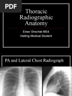 Thoracic Radiographic Anatomy: Einav Shochat MS4 Visiting Medical Student