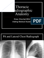 Thoracic Radiographic Anatomy: Einav Shochat MS4 Visiting Medical Student