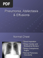 Pneumonia, Atelectasis & Effusions