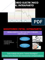 Mef Intraparto