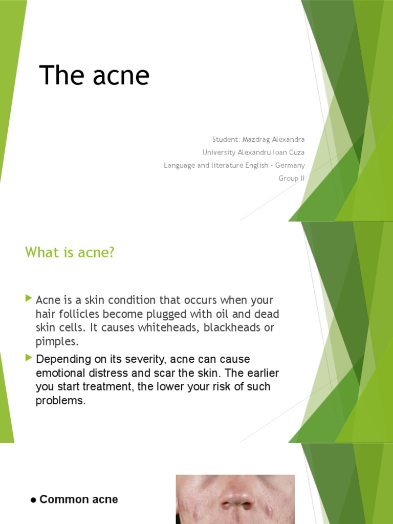 Understanding Acne: Causes and Treatments | PDF