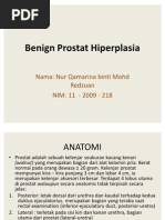 Download Benign Prostat Hiperplasia by Nur Qamarina SN49016331 doc pdf