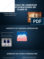 Protocolo de Adhesion de Restauraciones de Clase Iii