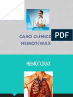 HEMOTÓRAX