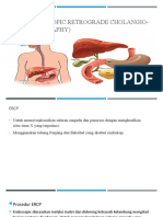 Ercp (Endoscopic Retrograde Cholangio-Pancreatofraphy)