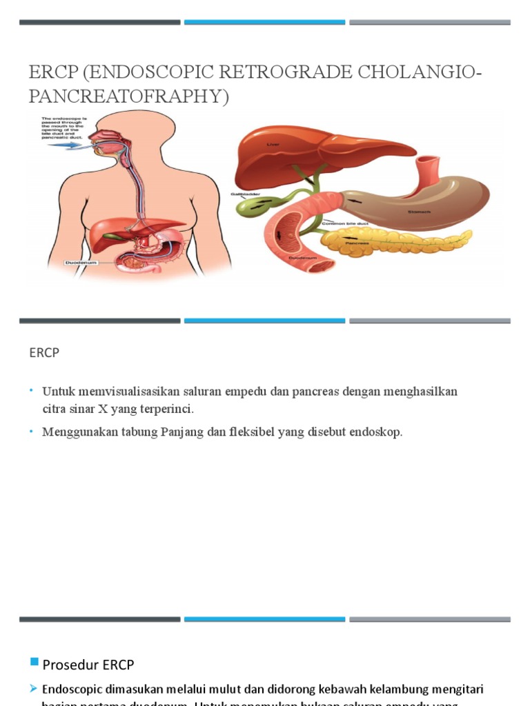 Ercp (Endoscopic Retrograde Cholangio-Pancreatofraphy) | PDF