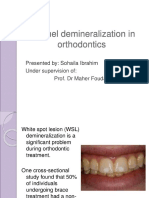 Enamel Demineralization in Orthodontics