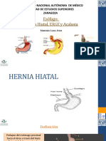 357472955-Hernia-Hiatal-ERGE-Acalasia.pptx