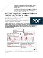 Elektrokardiogram