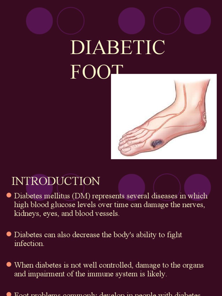 A Comprehensive Guide to Diabetic Foot Complications From