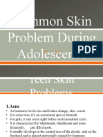 Common Skin Problem During Adolescence