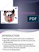 Epistaxis 130329165831 Phpapp02