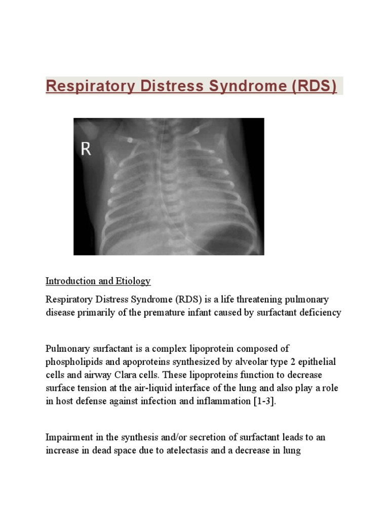 Understanding Neonatal RDS Causes and Treatment | PDF | Respiratory ...