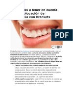 9 Consejos A Tener en Cuenta Tras La Colocación de Ortodoncia Con Brackets