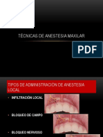 tcnicasdeanestesialocal-130919161525-phpapp02.pdf