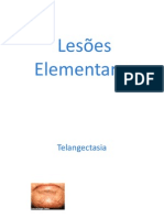 Lesoes elementares