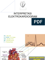 Interpretasi Elektrokardiogram