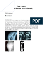 3 - Bone Tumors