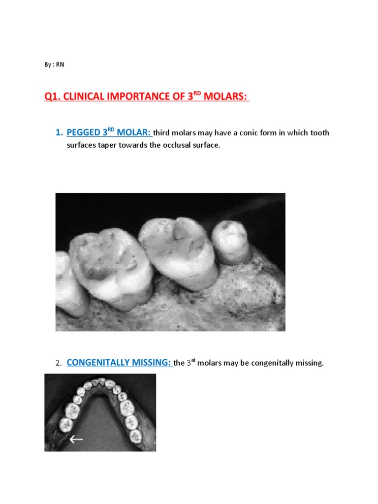 Clinical Overview of Third Molars | PDF | Social Science | Home & Garden