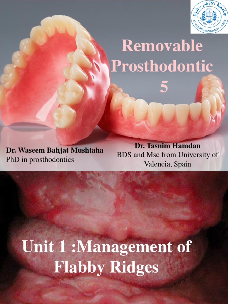 Unit 1.management of Flabby Ridge | PDF | Dentures | Dentistry Branches