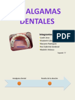 Amalgamas Dentales