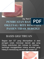 Oklusal Rim Pada Pasien Tidak Bergigi