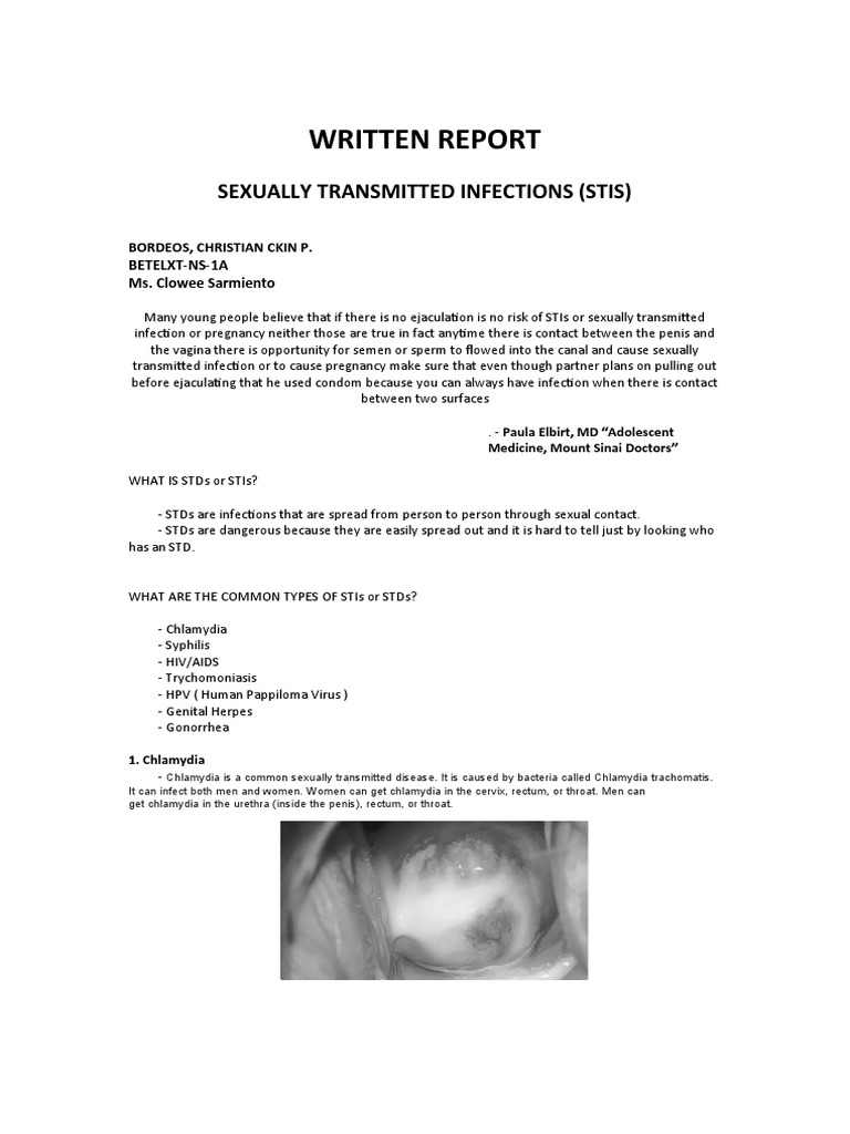 Written Report in Uts | PDF | Sexually Transmitted Infection | Hiv/Aids