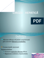 Ciroze Hepatice