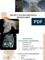Micro y Macroadenomas 