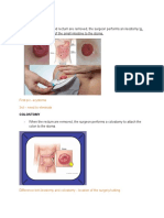 When The Colon and Rectum Are Removed, The Surgeon Performs An Ileostomy To Attach The Bottom of The Small Intestine To The Stoma