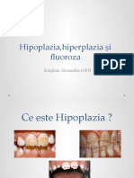 hipoplazia,hiperplazia,fluoroza.pptx