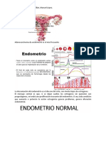 Patología Endometrial PDF