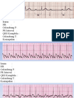 Latihan Interpretasi EKG Strip