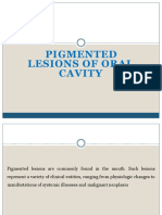 Pigmented Lesions of Oral Cavity